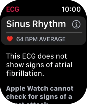 The result is displayed. The result is displayed.