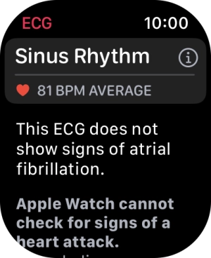 The result is displayed. The result is displayed.