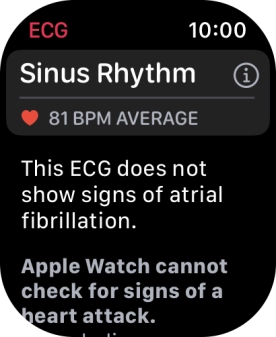 The result is displayed. The result is displayed.
