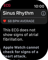 The result is displayed. The result is displayed.