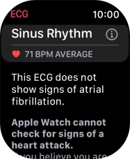 The result is displayed. The result is displayed.