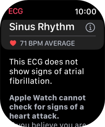 The result is displayed. The result is displayed.