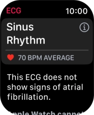 The result is displayed. The result is displayed.