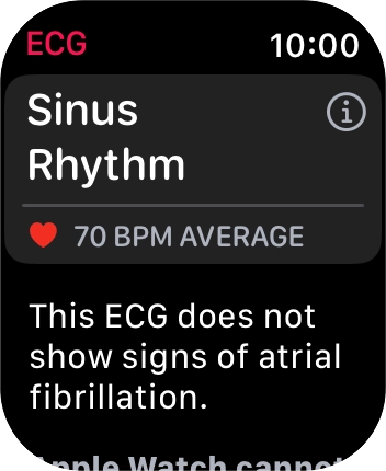 The result is displayed. The result is displayed.