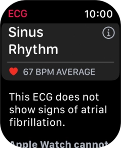 The result is displayed.