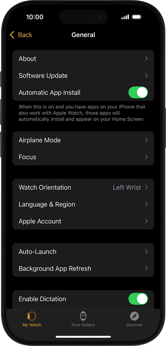 On your phone: Press Software Update. If a new software version is available, it's displayed. Follow the instructions on the screen to update the Apple Watch software.