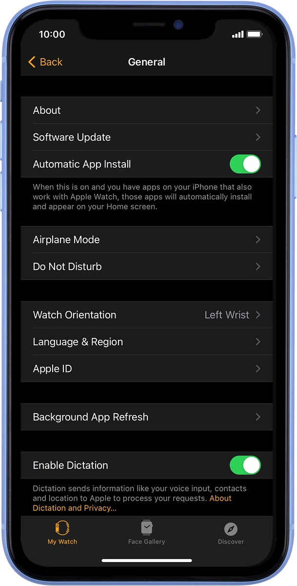 On your phone: Press Software Update. If a new software version is available, it's displayed. Follow the instructions on the screen to update the Apple Watch software.