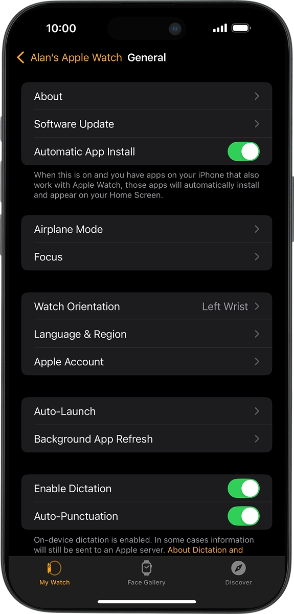 On your phone: Press Software Update. If a new software version is available, it's displayed. Follow the instructions on the screen to update the Apple Watch software.