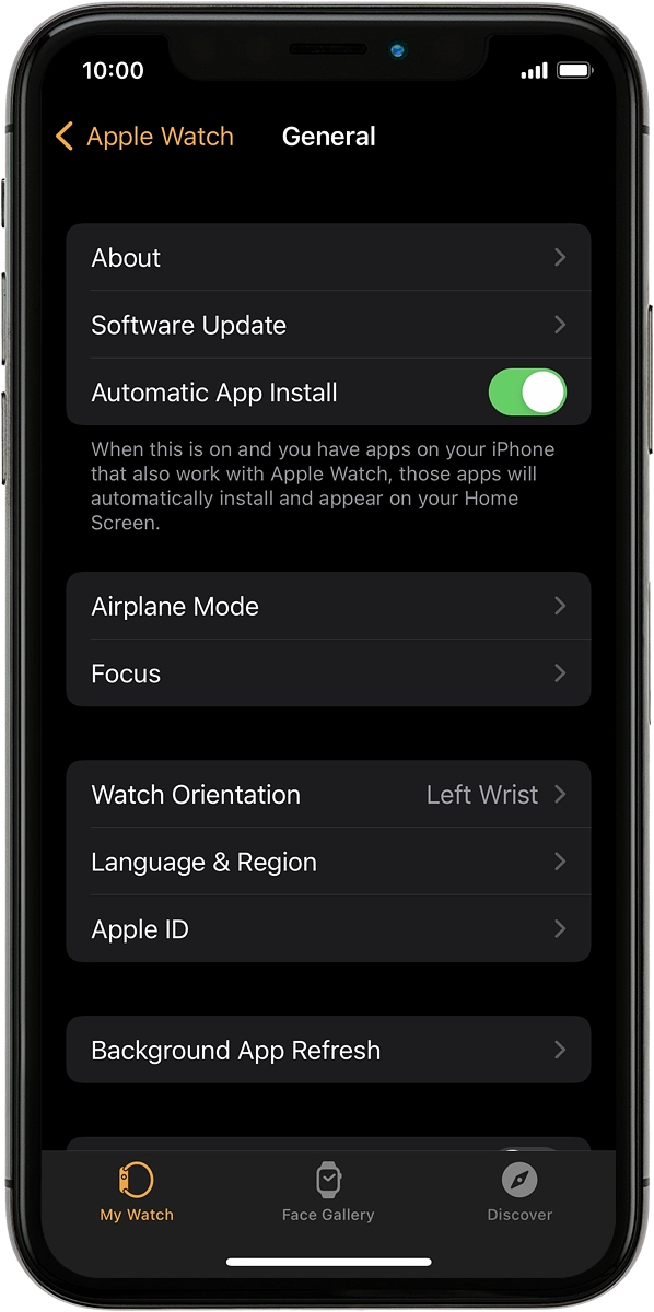 On your phone: Press Software Update. If a new software version is available, it's displayed. Follow the instructions on the screen to update the Apple Watch software.