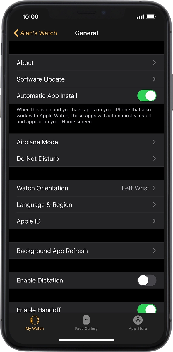 On your phone: Press Software Update. If a new software version is available, it's displayed. Follow the instructions on the screen to update the Apple Watch software.
