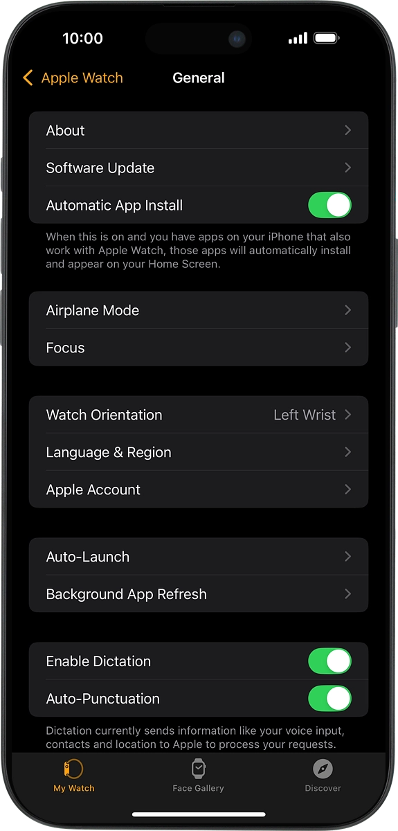 On your phone: Press Software Update. If a new software version is available, it's displayed. Follow the instructions on the screen to update the Apple Watch software.