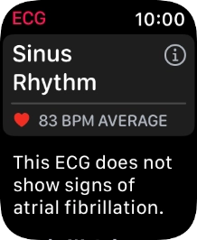 The result is displayed.